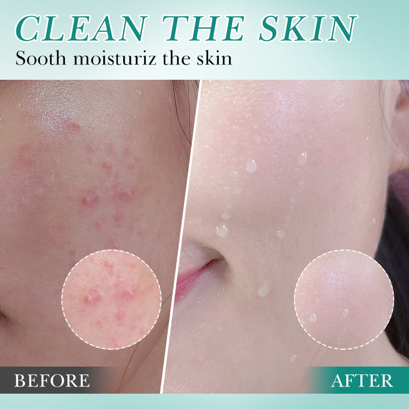 Bioaqua Hyaluronic Acid Cleanser – Limpiador Facial y Corporal Hidratante con Ácido Hialurónico (100ml)