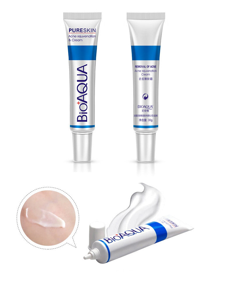 Bioaqua Crema Antiacné 30g – Control de Grasa, Reducción de Poros y Eliminación de Cicatrices