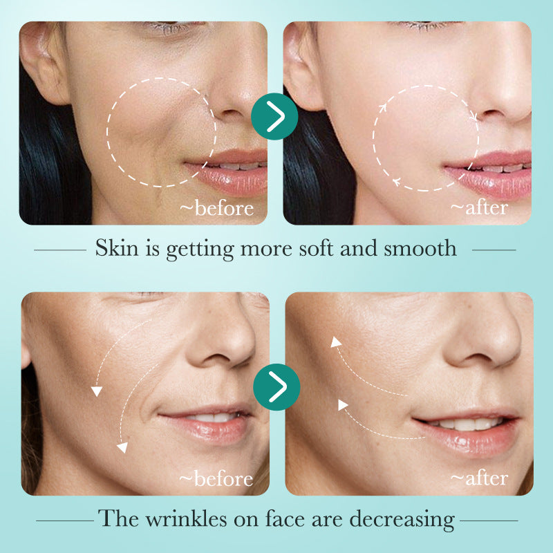 Before and after comparison of skin texture and wrinkles on a person's face with text indicating improvement.