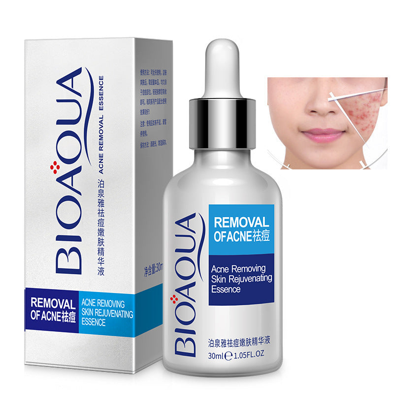 Bioaqua Serum Facial Antiacné – Esencia Hidratante y Aclarante 30ml