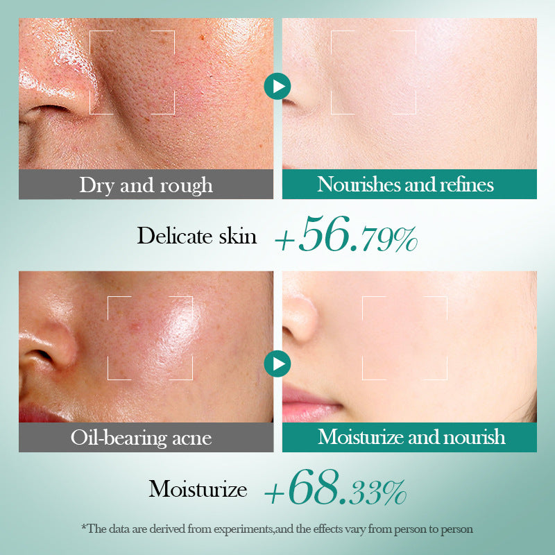 Kit Bioaqua Ácido Hialurónico 6 en 1 – Set Facial Hidratante, Reafirmante y Reparador con Efecto Iluminador