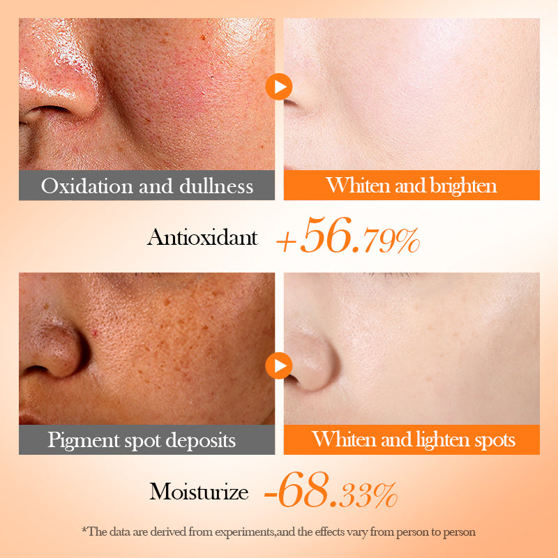 Bioaqua Vitamina C 5 en 1 – Set Facial Antioxidante, Iluminador e Hidratante con Extractos Herbales Naturales