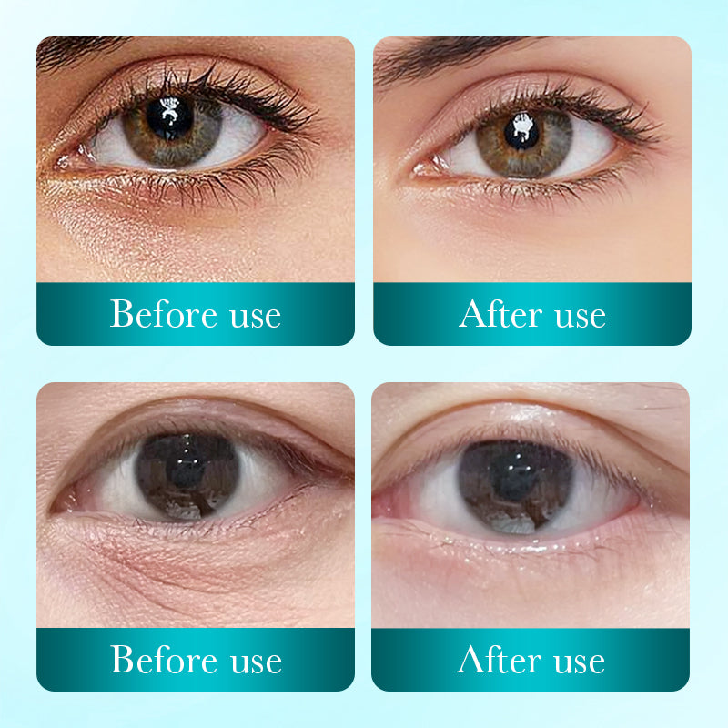Before and after use comparison of eye treatment on a person's eyes.