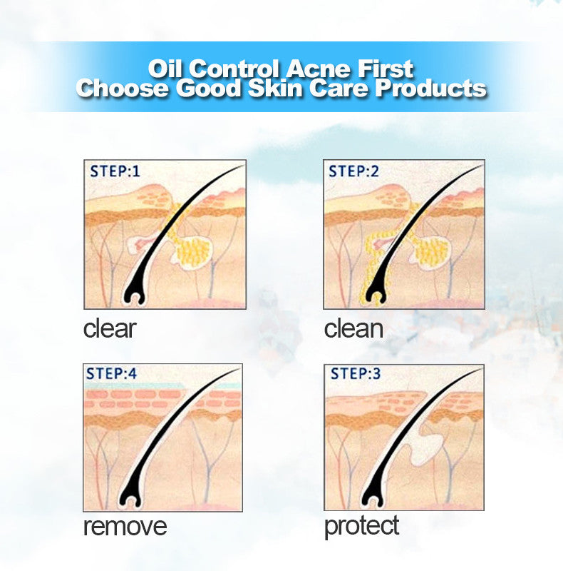 Bioaqua Crema Antiacné 30g – Control de Grasa, Reducción de Poros y Eliminación de Cicatrices