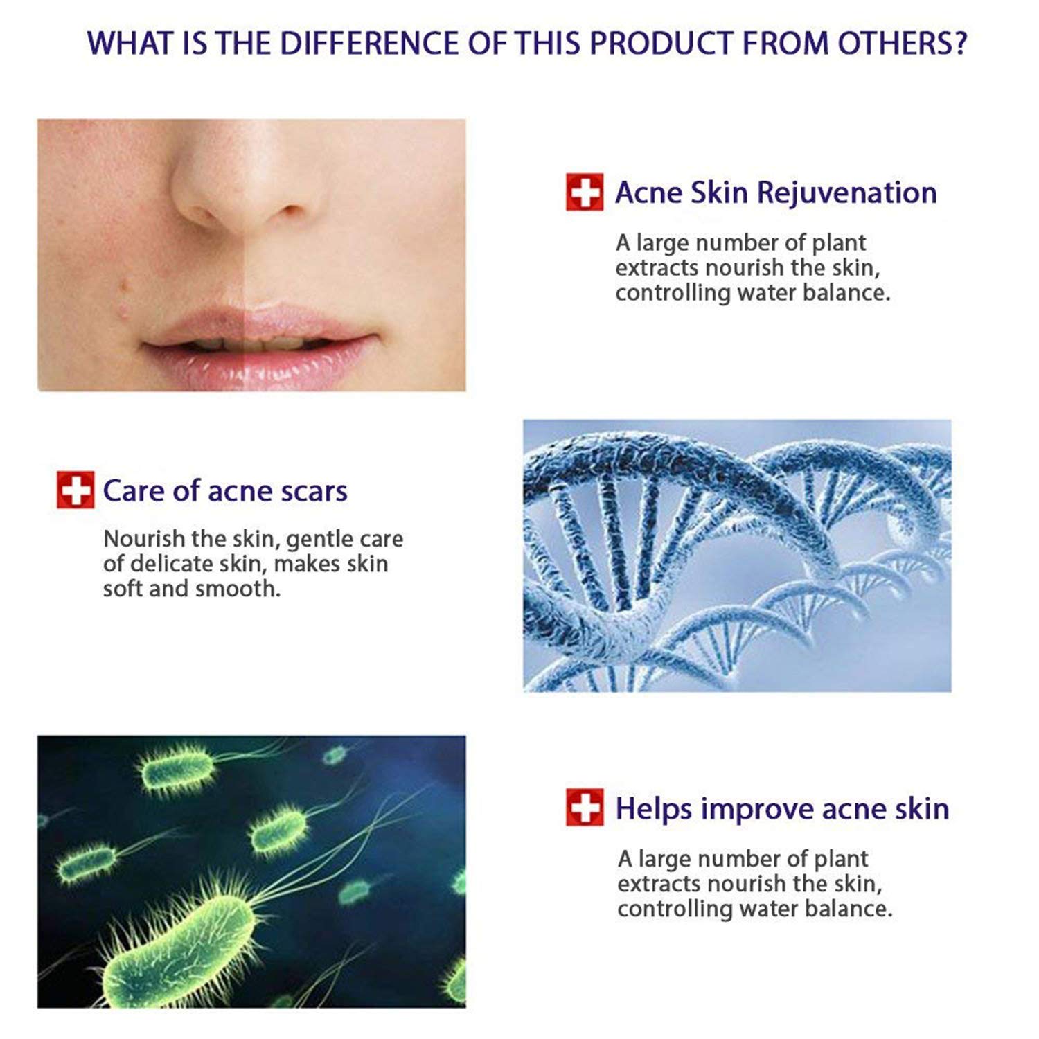 Kit Bioaqua 4 en 1 Antiacné – Limpieza Profunda, Hidratación y Eliminación de Manchas y Cicatrices